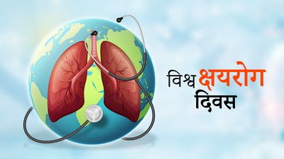 आज विश्व क्षयरोग दिवस मनाइँदै